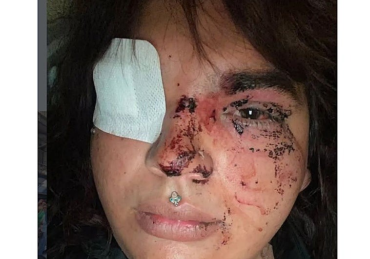 Una agresión tránsfoba que no es un hecho aislado